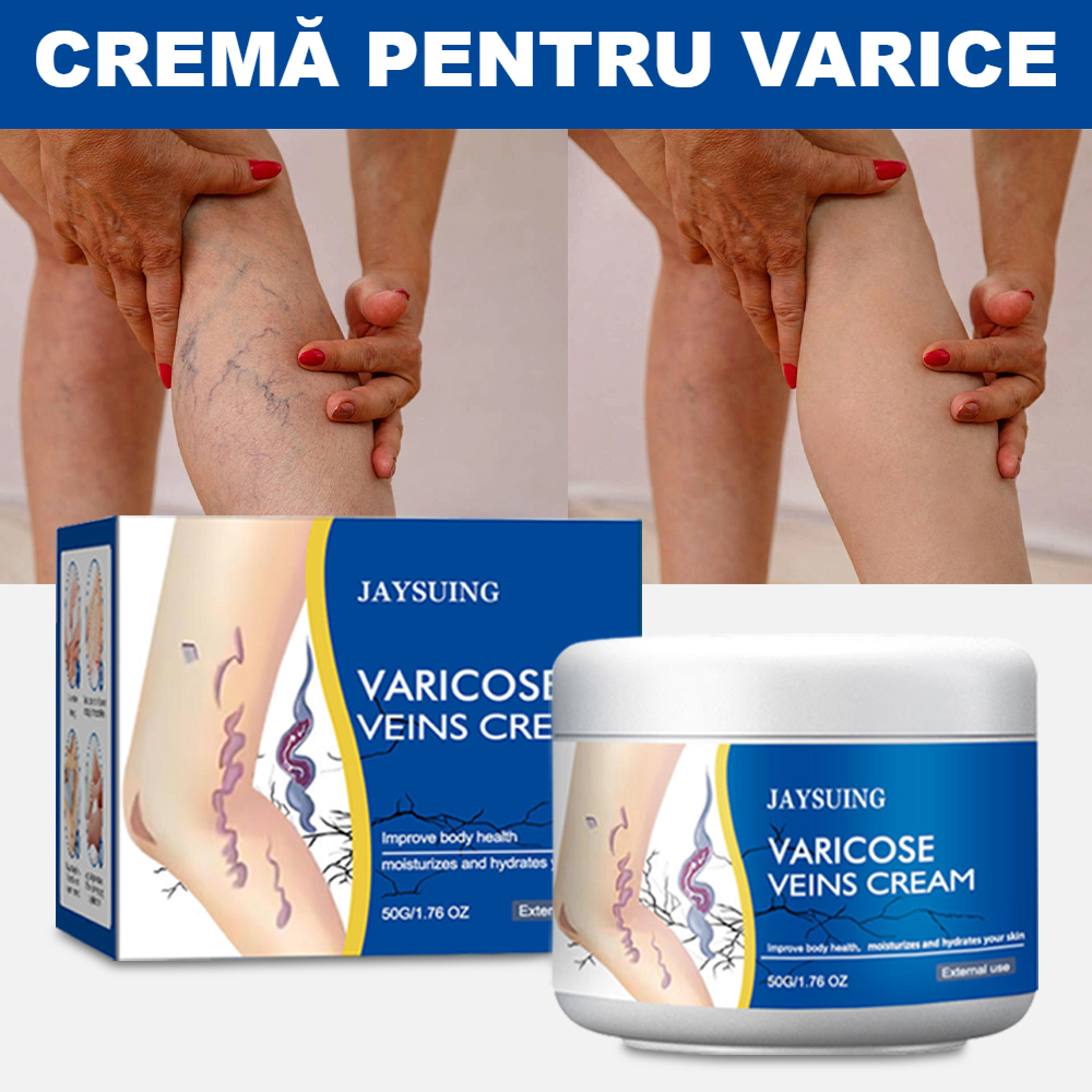 Cremă pentru Varice JAYSUING — Formulă Asiatică Premium, Ameliorează Durerea și Reduce Venele Varicoase